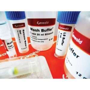 Viral Nucleic Acid Extraction Kit III 100 Preps